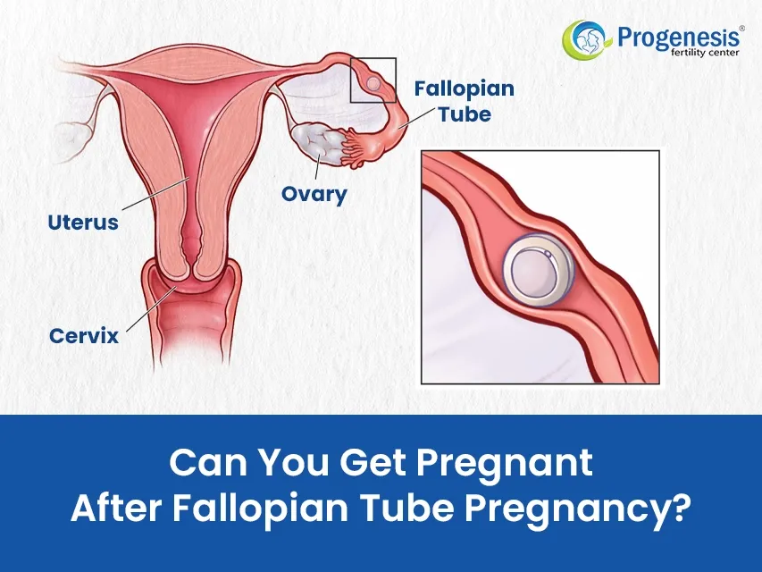 Can You Get Pregnant After Fallopian Tube Pregnancy?